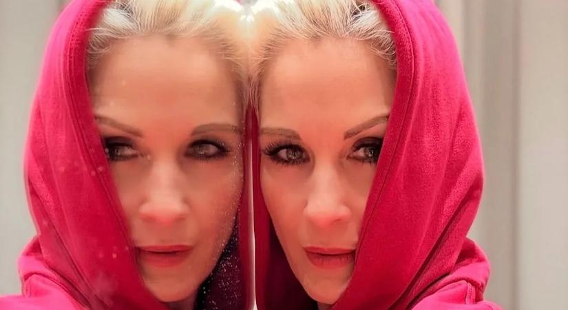 "Eltorzítják a vonásaikat" – Orosz Barbara kendőzetlen őszinteséggel beszélt a plasztikai beavatkozásokról