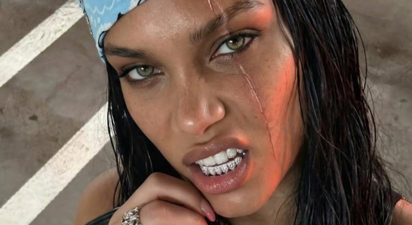 A sebhelyével együtt gyönyörű ez a lány