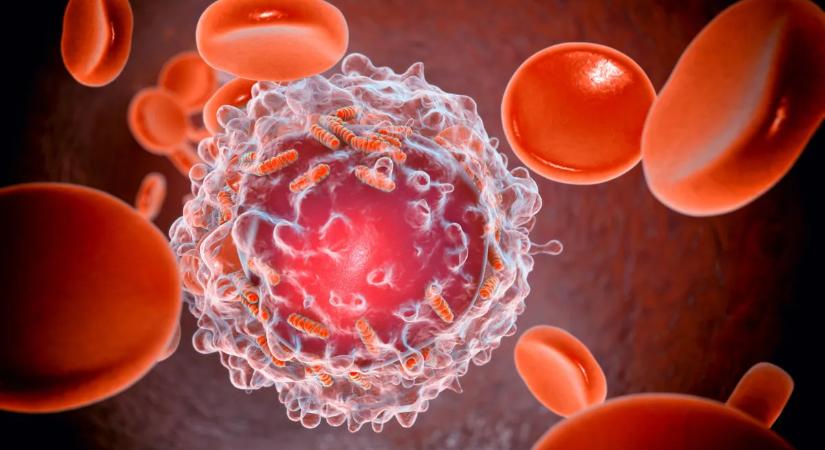 "Azt hittem, fáj a fejem a maratoni futástól, de vérrákom volt"