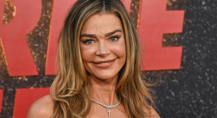 Denise Richards előtte-utána fotókat mutatott arcplasztikájáról, döbbenetes a változás