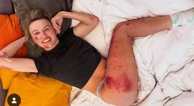 Kész csoda, hogy túlélte a horrorbukást az olasz kerékpározó