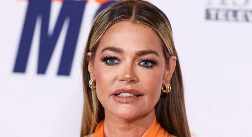 Denise Richards megmutatta, hogyan változott az arca ráncfelvarrás után