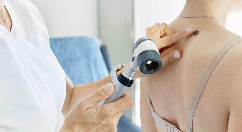 Magánrendelők is csatlakoztak az ingyenes szűrővizsgálatokhoz