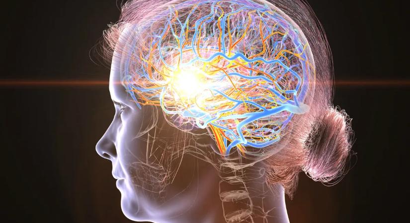 Megvan a stroke ellenszere? Milliók életét mentheti meg egy új terápia