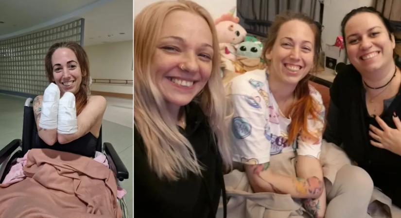 „Kéz és láb nélkül nyomtuk a bulit!” – hazaengedik hétvégenként a négy végtagját elvesztett Fannit, így van most a bájos fodrászlány