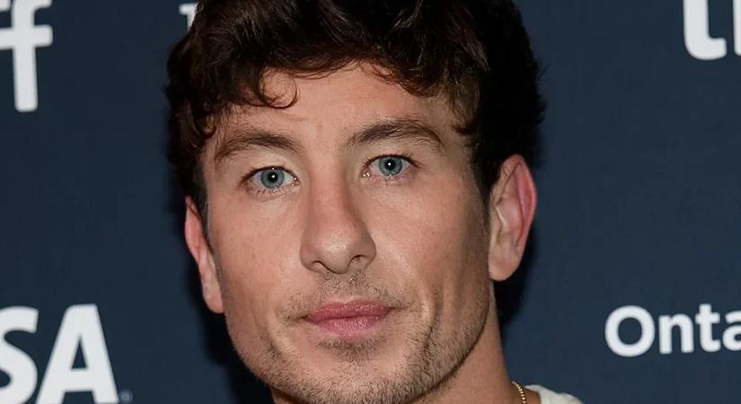 Az utcára sem mer kimenni az ír színész, annyian bántják a külseje miatt