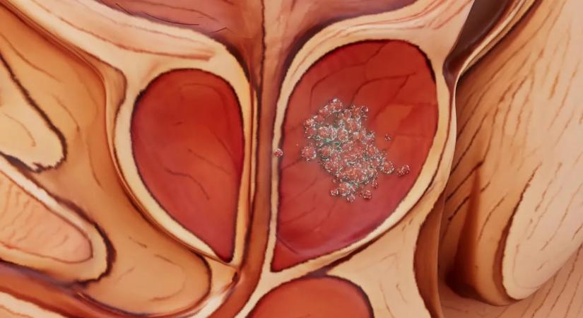 Ez a népszerű ital növelheti egy súlyos rák kockázatát