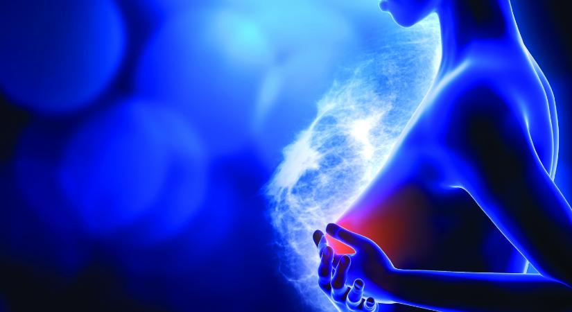 Új technológia gyorsítja az emlőrák korai felismerését