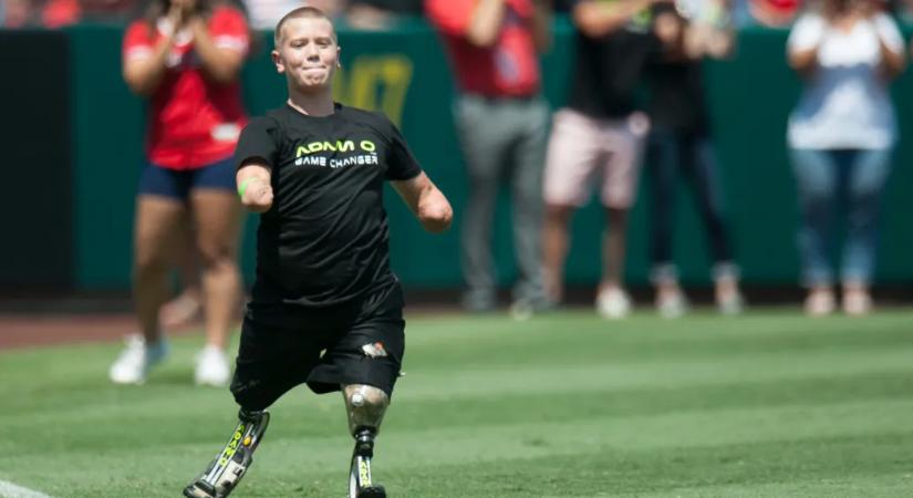 Vezetés közben lőhette agyon utasát egy férfi, akinek gyerekkorában minden végtagját amputálták