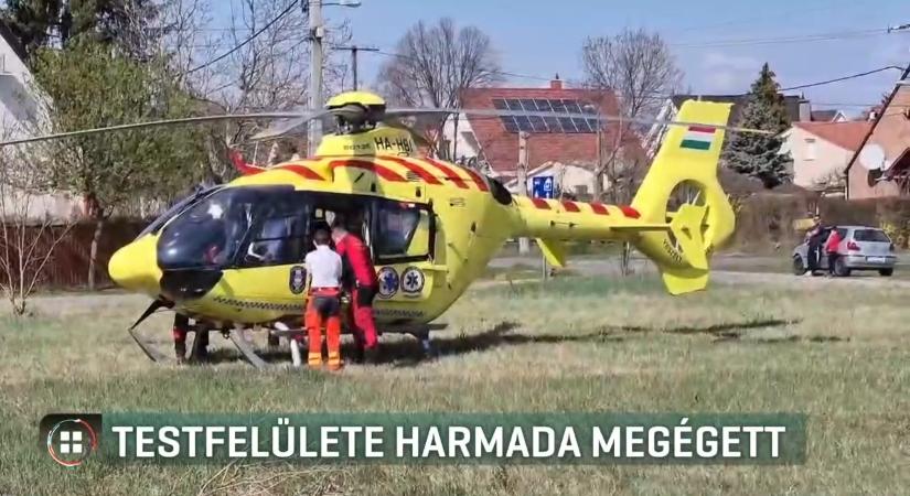 Súlyos égési sérüléseket szenvedett egy hajdúszoboszlói kislány a forró bográcsba esve