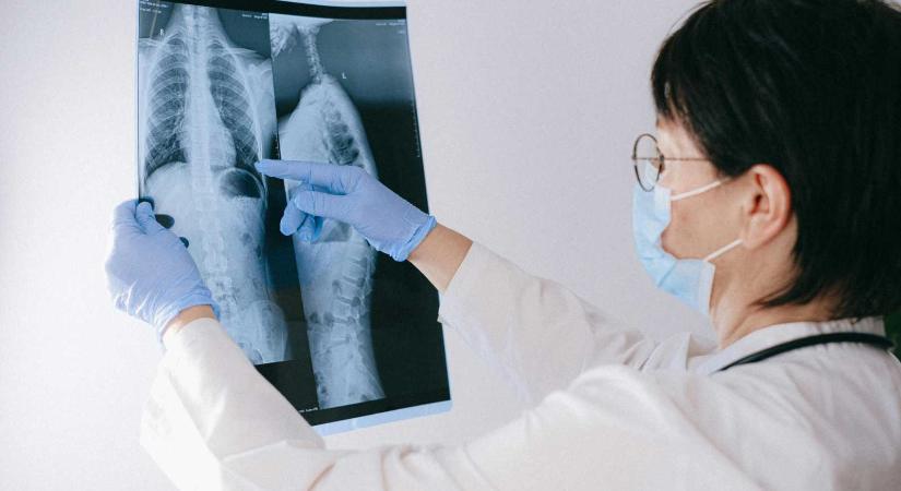 A tuberkulózis továbbra is komoly kihívás Romániában – Szűrőkaraván járt Hargita megyében