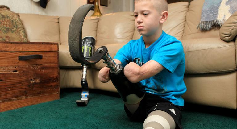 Mind a négy végtagját amputálták, most gyilkosságért tartóztatták le