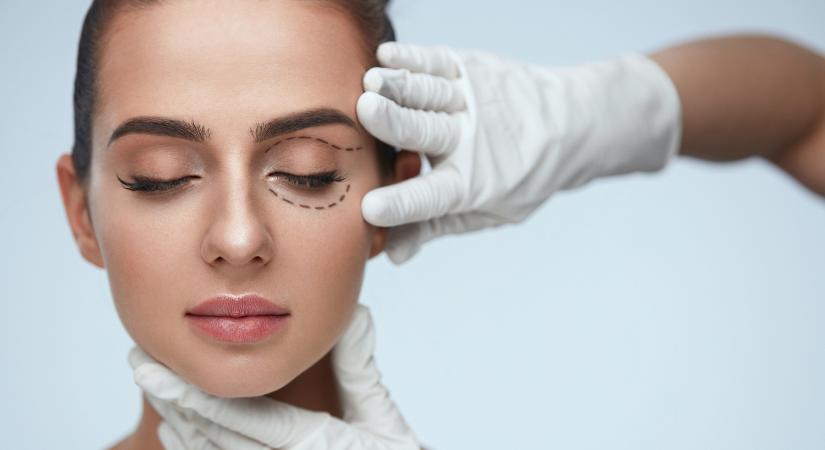 Szemhéjplasztika: minden, amit tudni akartál róla