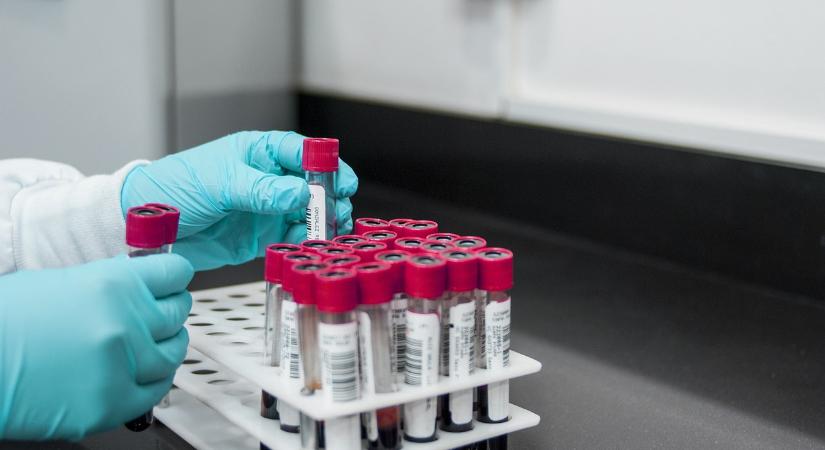 Újabb szűrés lesz kötelező a várandós nőknek