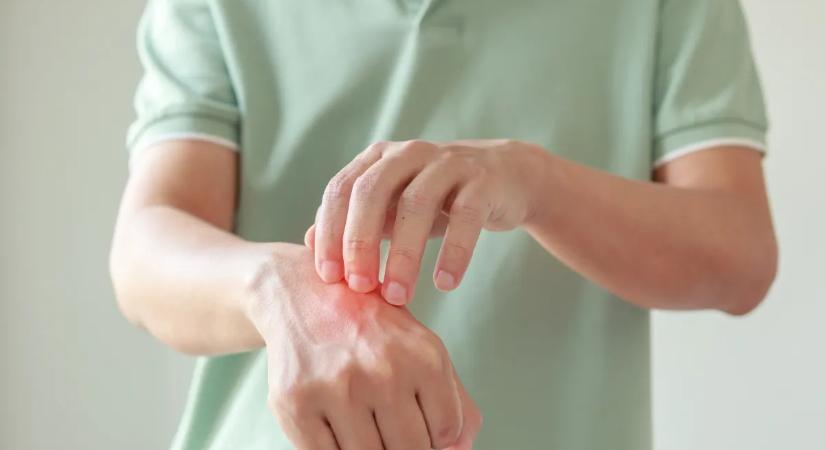 Ekcémát is okozhat a házimunka? Ezeket a jeleket sokan túl későn veszik észre