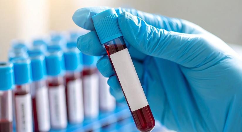 Megmondható egy vérvételből, hány éved van hátra