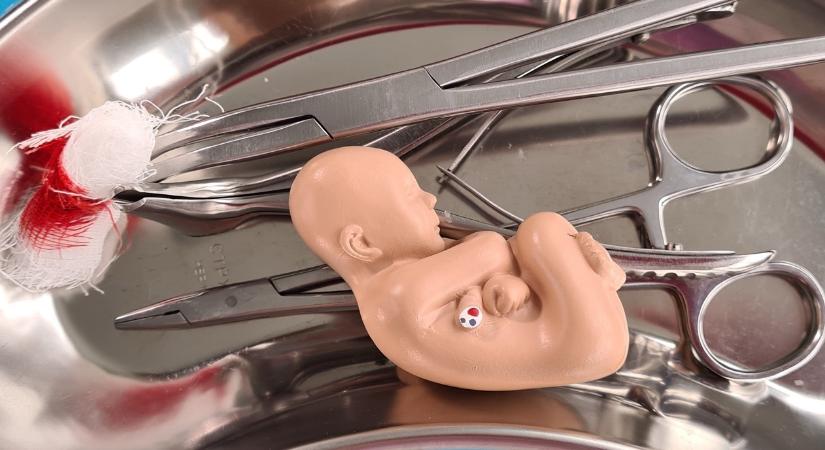 Megtorpant az abortuszoffenzíva