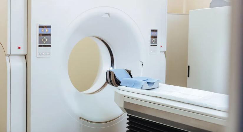 ,,Az hittem meghalok" - Évekig fájt a feje, golflabda méretű agydaganata nőtt