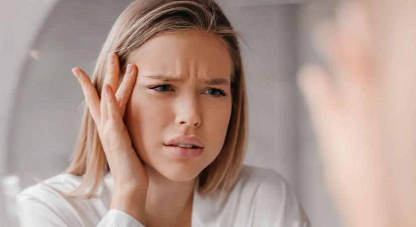 Ha ezt látod az arcodon, magnéziumhiány is állhat a háttérben