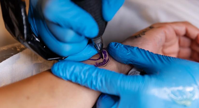 Csak meg akart szabadulni a tetoválásától, borzasztó mi történt a fiatal nő lábával