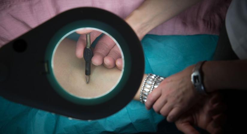 Afrikában a vadászok a kígyómarás miatt védekeznek, mi sem nyugodhatunk