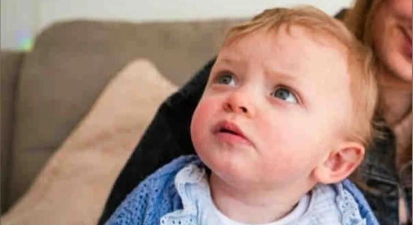 Ez lehet az utolsó születésnapja: rákos anyajegy borítja be a 10 hónapos kislány hátát