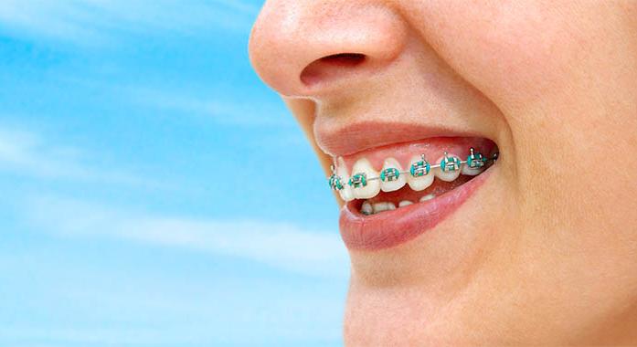 A fogszabályozás hatása a fasciarendszerre és az állkapocsízületre