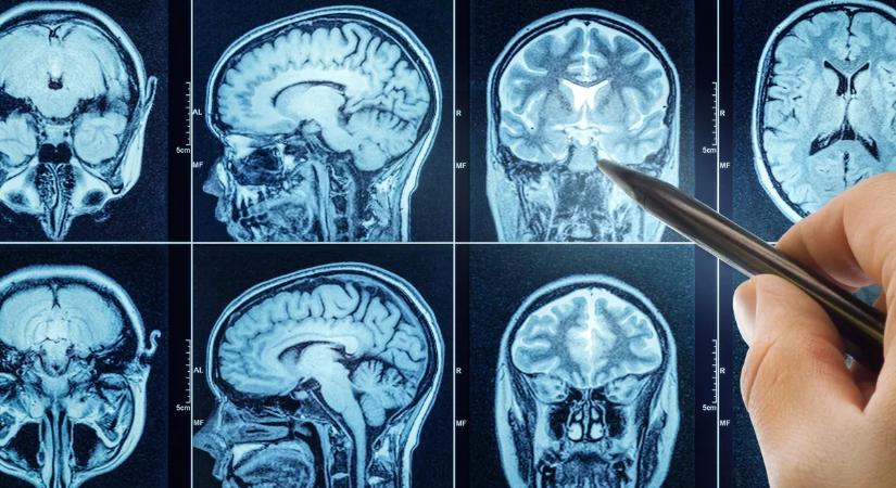Sokkoló diagnózis: csak stressznek hitte a tüneteket az apa – valójában sokkal rosszabb volt a háttérben