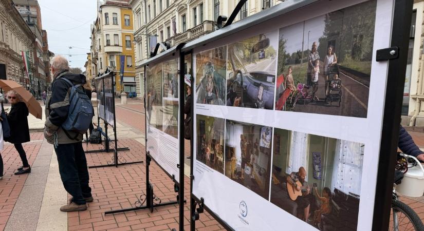 Nem csak a betegek küzdenek: megrendítő kiállítás nyílik Szeged szívében