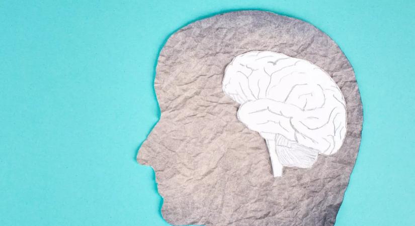 Nem győzi ismételni a neurológus: ez a 3 étel a legveszélyesebb az agyra