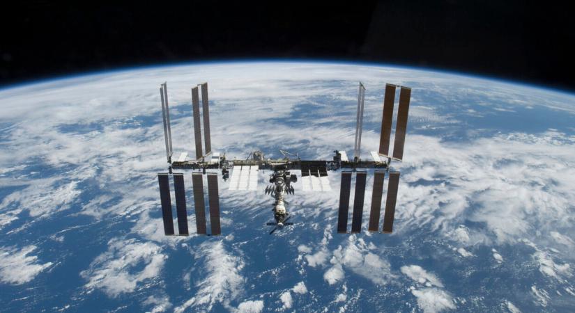 Az űrhajós hirtelen elfelejtett beszélni a Nemzetközi Űrállomáson, de az orvosok a mai napig nem tudják, mi történhetett vele