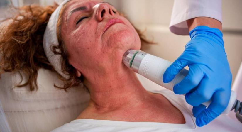 Éveket fiatalodik tőlük az arcbőr nyárig: 5 arckezelés ráncok, petyhüdtség és foltok ellen