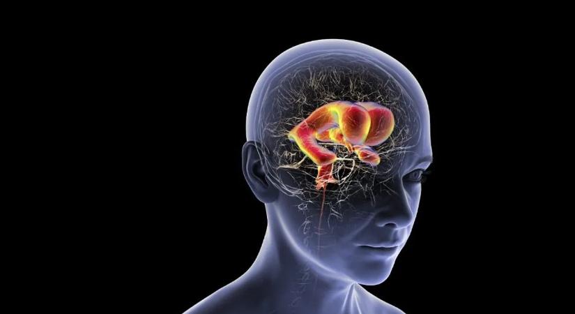 A demencia kockázata elszállhat, ha ilyen a családi kapcsolata