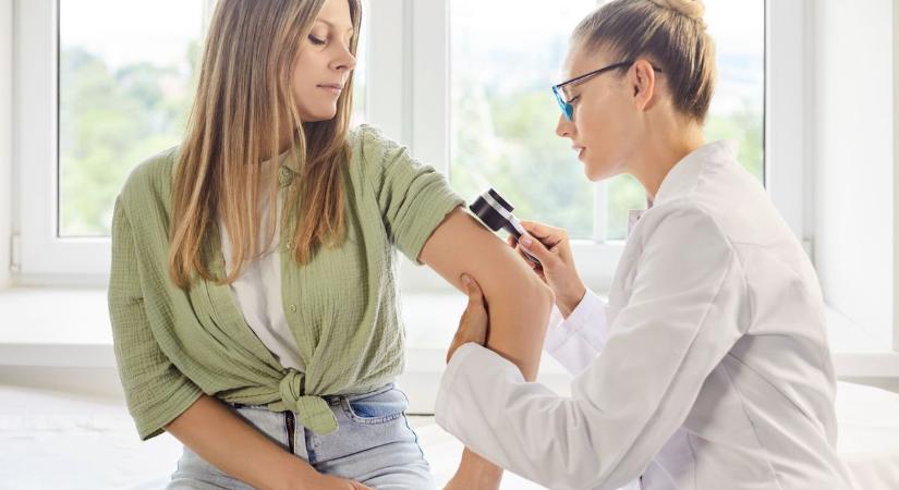 Több ezer embert várnak: ingyenes bőrrákszűrés segíthet a baj megelőzésében