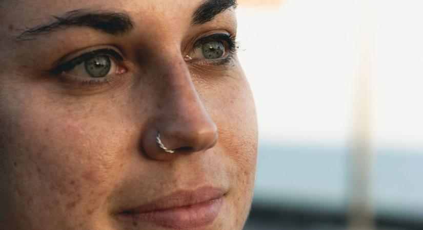 Ördögi kör, amiből nehéz kiszállni: a kozmetikus elárulta, miért térnek vissza minden tavasszal a májfoltok