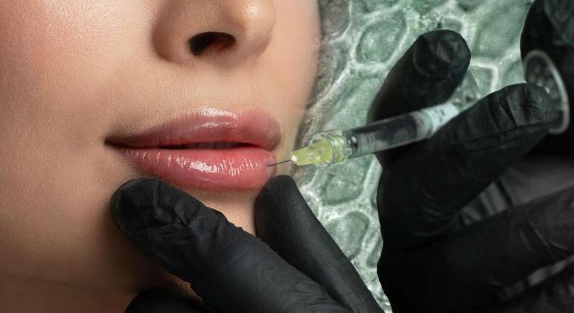 Már halott donortól származó zsírszövetekkel is feltöltethetjük a szánkat – Mi ez a zombi töltőanyag?