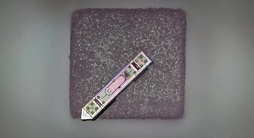 Ilyen lehet a jövő orvoslása: mikroszkopikus implantátumot ültetnek az agyba