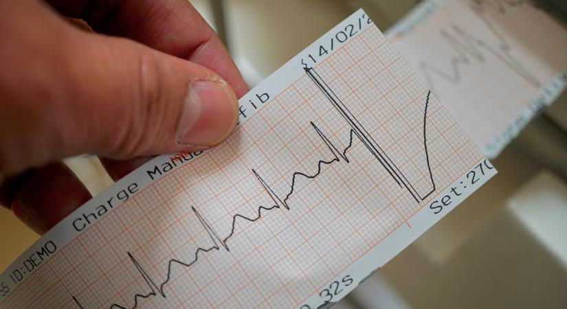 Mit jelez a szapora szívverés? Íme a leggyakoribb okai – Mutatjuk, mikor fordulj orvoshoz