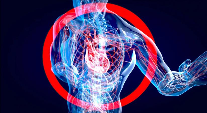 Döbbenet: ezzel a három apró trükkel elkerülhető az infarktus és a stroke