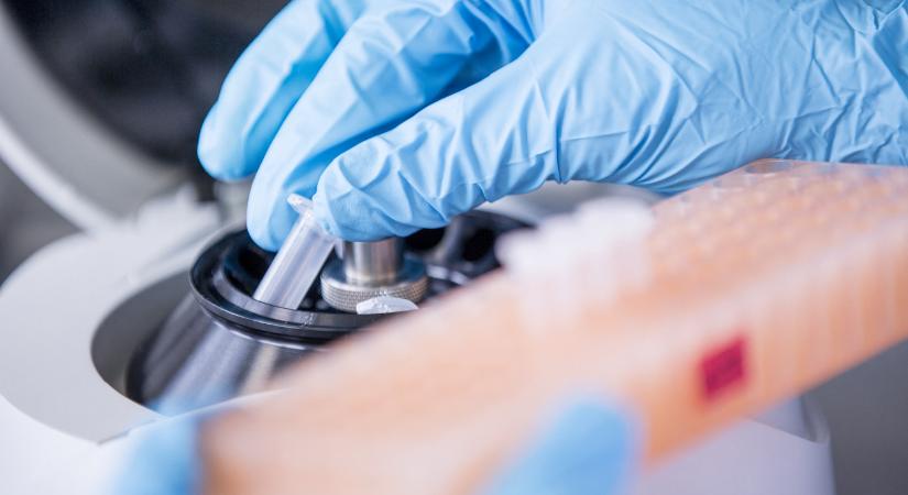 Több mikroműanyagot találnak azok a kutatók, akik gumikesztyűt hordanak