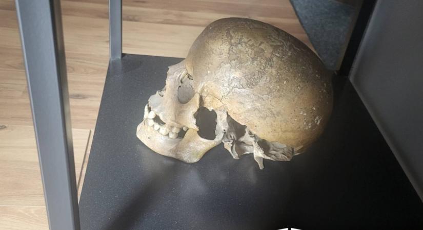 Kapott az apja egy népvándorlás kori koponyát egy régésztől, a fia három és fél millióért árulta a neten