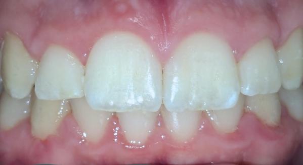 Legjobb fogorvosok Újpesten – Komprehenzív szemlélet és SPECIALISTA csapat a IV. kerületben