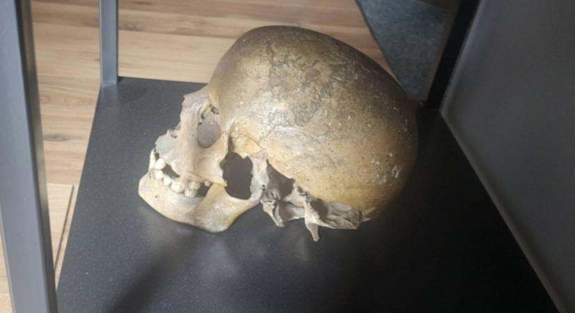 Népvándorlás kori koponyát árult az interneten, a rendőrség ugrott a hirdetésre
