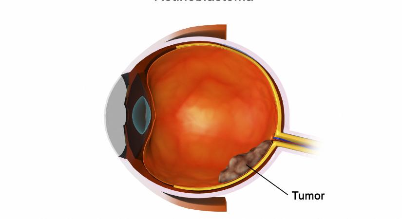 A disznósperma lehet a kulcs a szemrák kezelésében