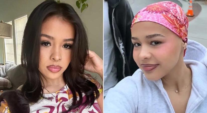 Borzasztó fájdalmak kínozták a fiatal lányt: az orvosok is ledöbbentek a végső diagnózison