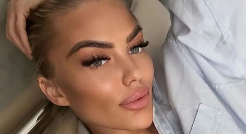 Kés alá feküdt Géczi Bea, sokkoló műtétjéről vallott: „Már zavart, hogy ilyen nagy...”