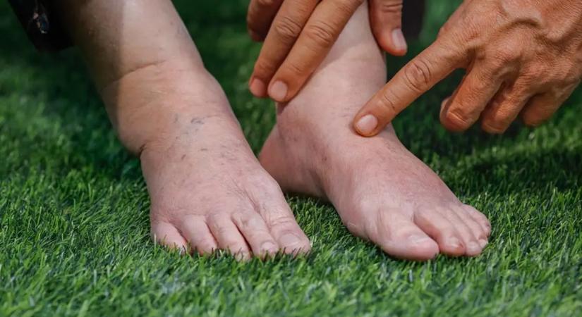 A bokaduzzanat leggyakoribb okai