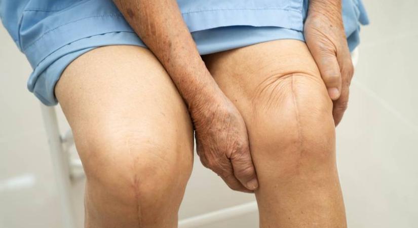 Van, aki két évig vár egy térdprotizésre: Riasztó adatok láttak napvilágot