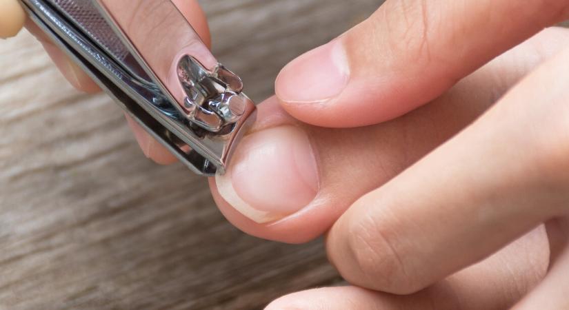 A legtöbben rosszul vágják a lábkörmüket – ezért alakul ki a benőtt köröm