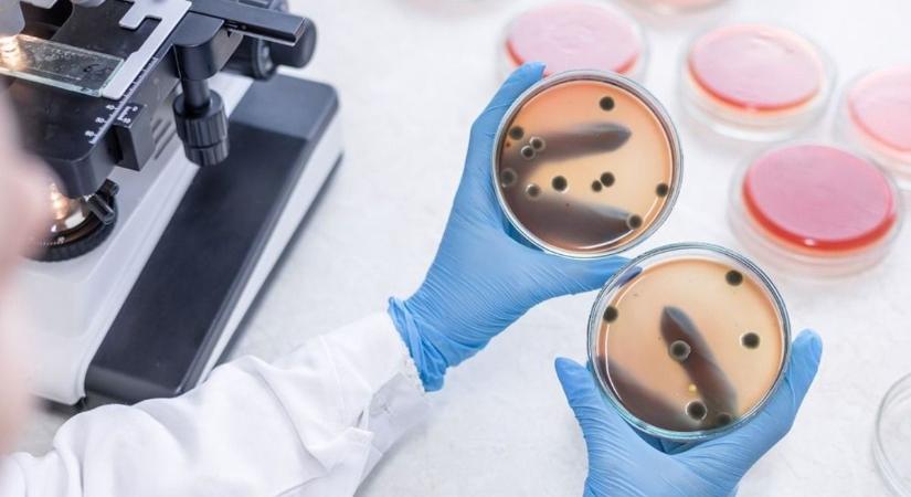 Fontos változást mértek a szakemberek: visszavonulót fújt a vírus Szegeden